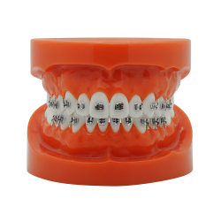 Günstiges KFO Metall Mini Bracket (Kostenloser EU Versand)