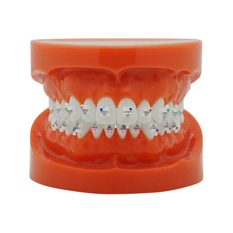 Selbstligierendes Keramikbracket (Kostenloser Versand) Selbstligierendes Keramikbracket (Kostenloser Versand)