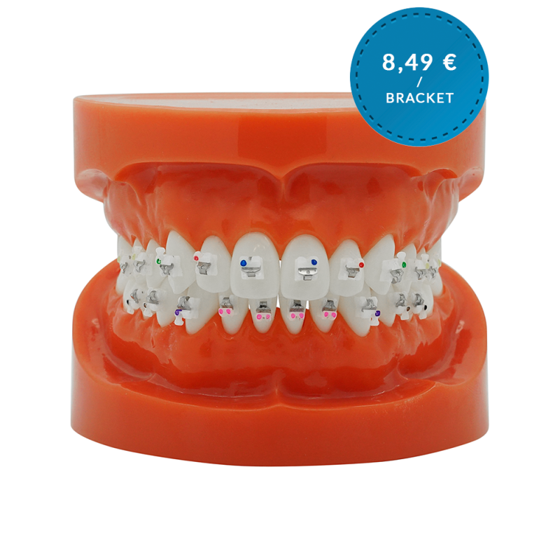 Selbstligierendes Keramikbracket (Kostenloser Versand)