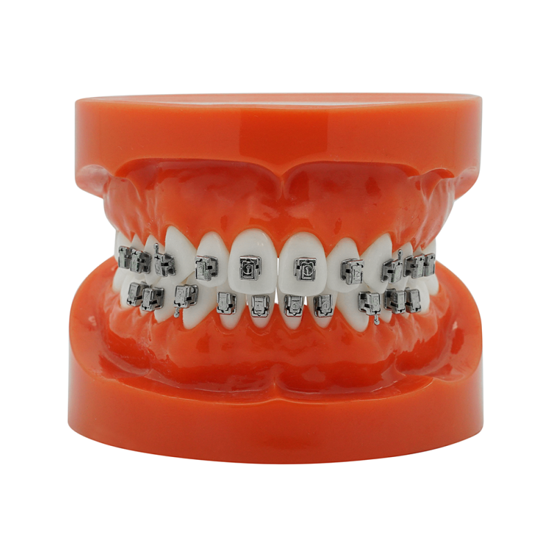 Smart Slide Selbstligierendes Metallbracket (Kostenloser Versand) Smart Slide Selbstligierendes Metallbracket (Kostenloser Versand)