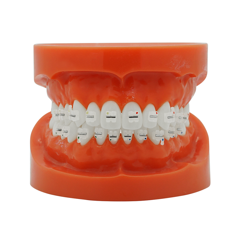 KFO Keramikbracket mit Metallslot (Kostenloser EU Versand)