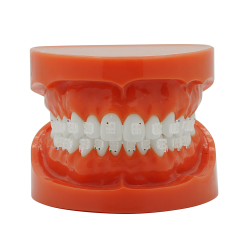 Durchsichtiges KFO Saphirbracket (Kostenloser EU Versand)