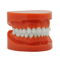 Durchsichtiges KFO Saphirbracket (Kostenloser EU Versand)