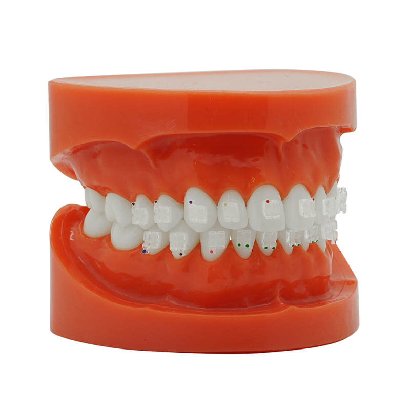 Durchsichtiges KFO Saphirbracket (Kostenloser EU Versand)