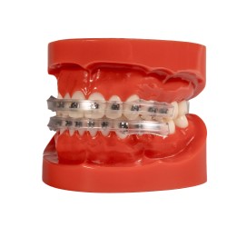 Lippenschutz für Brackets ( 2x )