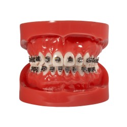 Selbstligierendes Metallbracket (Kostenloser Versand)